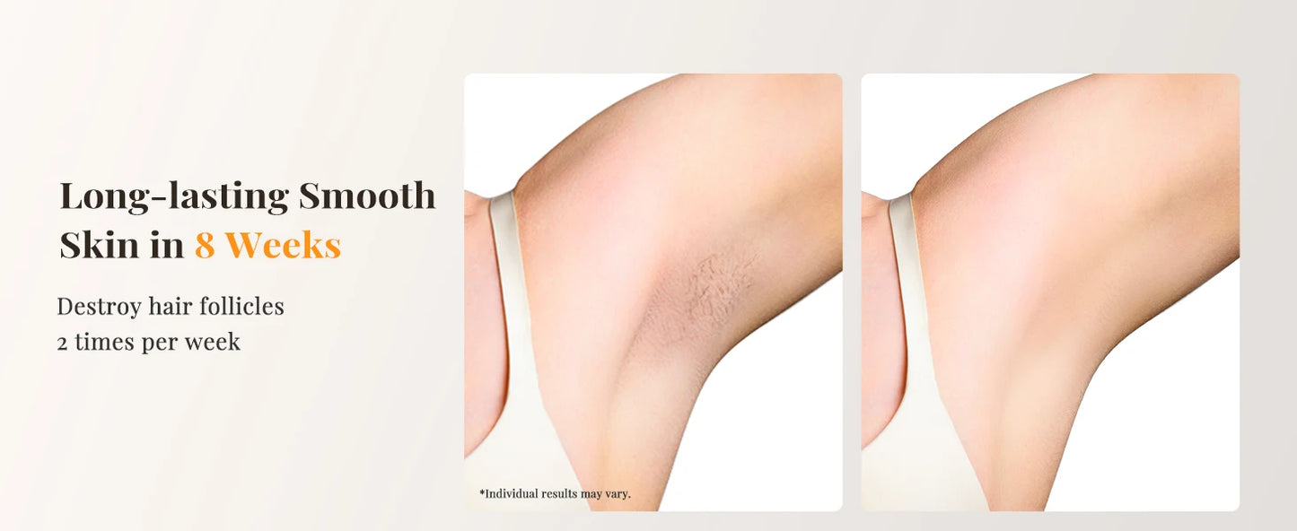 Professional IPL Laser Hair Removal For Women and Men Ice-Cooling Painless ElectricDepilator Body Bikinis Permanent Depilation