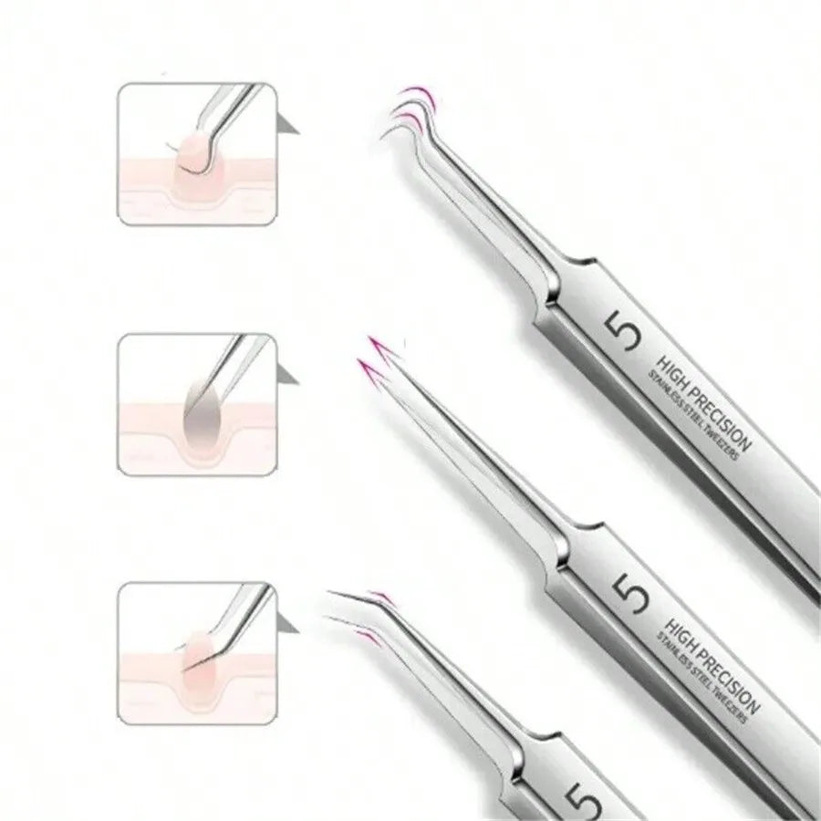 8pcs Acne, Blackhead, Dark Spot, Pimple Remover Tool Set, Skin Care Beauty, Pore Cleansing Kit