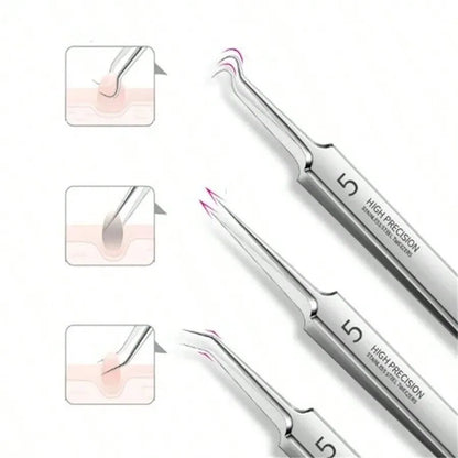 8pcs Acne, Blackhead, Dark Spot, Pimple Remover Tool Set, Skin Care Beauty, Pore Cleansing Kit