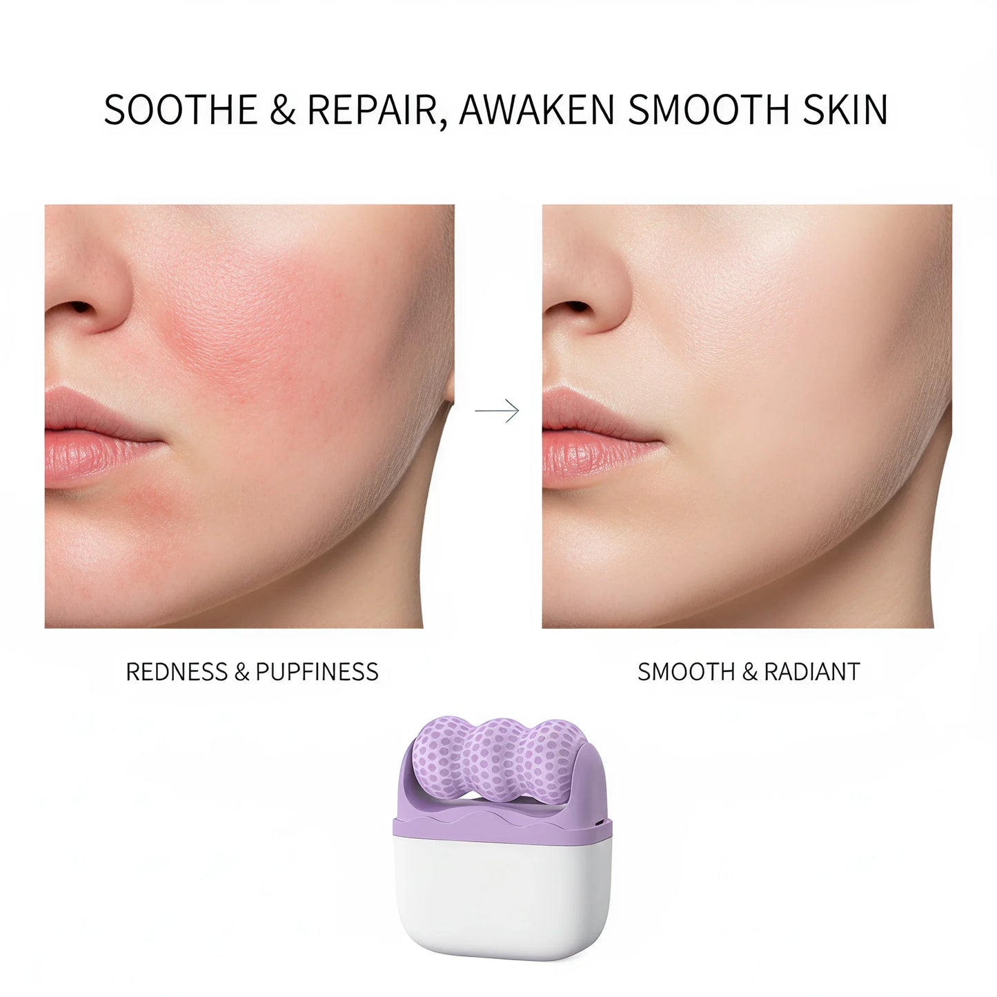Ice roller reduces puffiness
