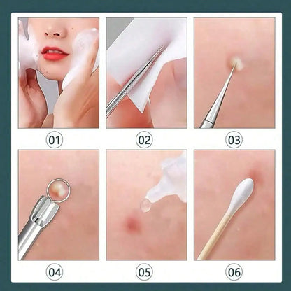 8pcs Acne, Blackhead, Dark Spot, Pimple Remover Tool Set, Skin Care Beauty, Pore Cleansing Kit