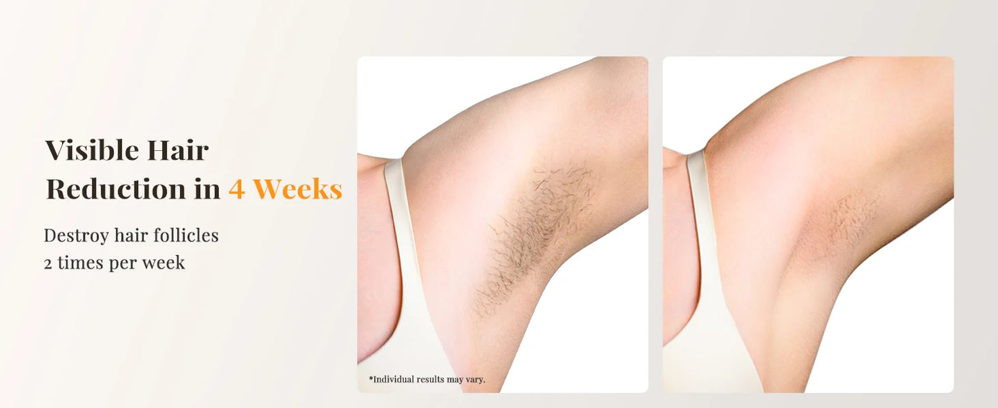Professional IPL Laser Hair Removal For Women and Men Ice-Cooling Painless ElectricDepilator Body Bikinis Permanent Depilation