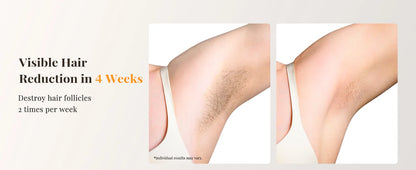 Professional IPL Laser Hair Removal For Women and Men Ice-Cooling Painless ElectricDepilator Body Bikinis Permanent Depilation