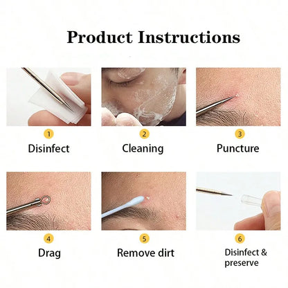 8pcs Acne, Blackhead, Dark Spot, Pimple Remover Tool Set, Skin Care Beauty, Pore Cleansing Kit