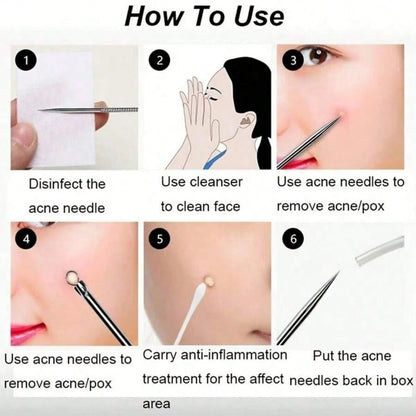 4-Piece Comedone Remover Tools – Acne/Blackhead Needles, Deep Cleansing Skin Care Gadgets for Women