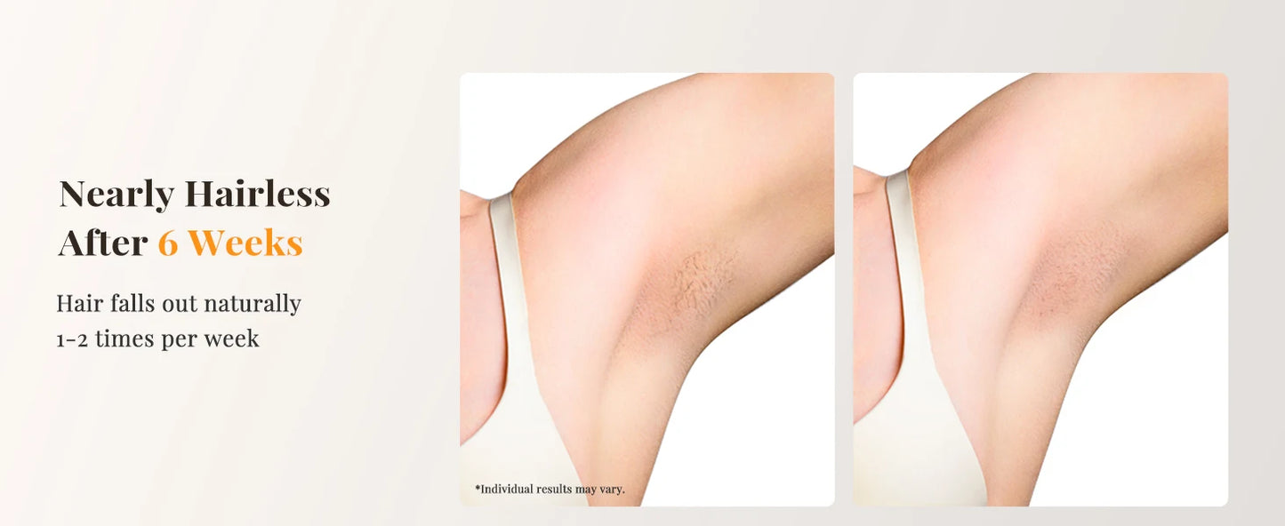 Professional IPL Laser Hair Removal For Women and Men Ice-Cooling Painless ElectricDepilator Body Bikinis Permanent Depilation