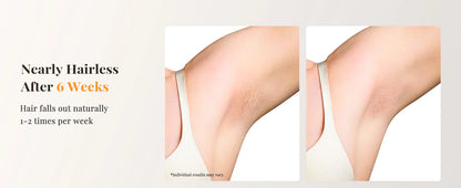 Professional IPL Laser Hair Removal For Women and Men Ice-Cooling Painless ElectricDepilator Body Bikinis Permanent Depilation