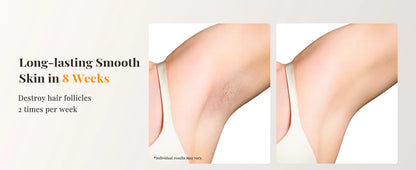 Professional IPL Laser Hair Removal For Women and Men Ice-Cooling Painless ElectricDepilator Body Bikinis Permanent Depilation